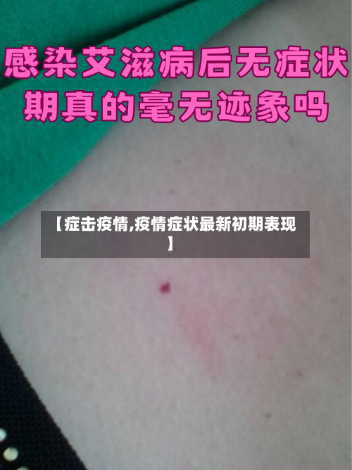 【症击疫情,疫情症状最新初期表现】