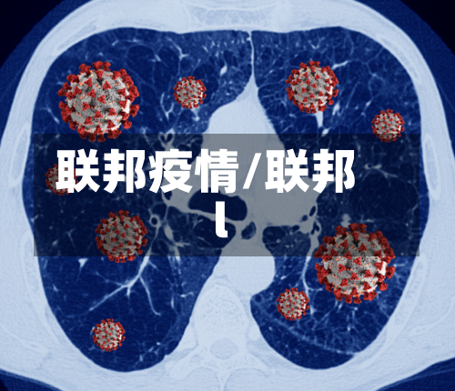 联邦疫情/联邦l-第2张图片