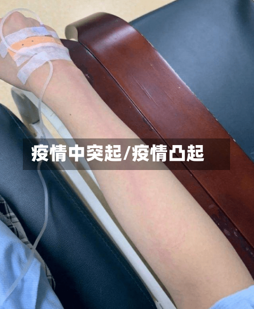 疫情中突起/疫情凸起-第3张图片