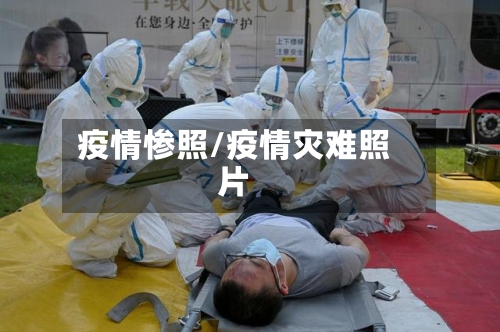 疫情惨照/疫情灾难照片-第3张图片